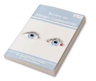 Review on Allergic Conjunctivitis