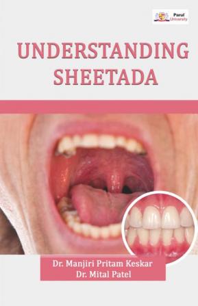 Understanding Sheetada (Gingivitis)