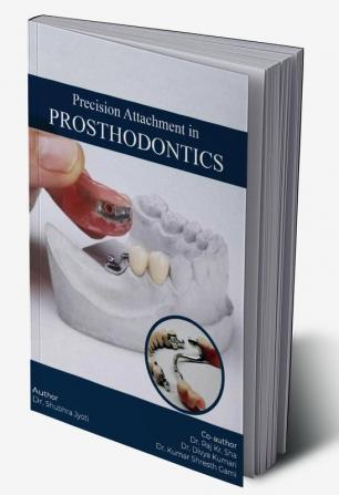 PRECISION ATTACHMENT IN PROSTHODONTICS