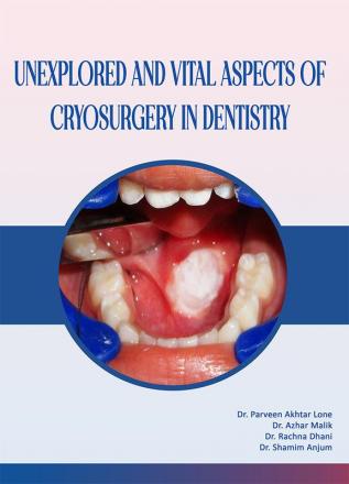 UNEXPLORED AND VITAL ASPECTSOF CRYOSURGERY IN DENTISTRY