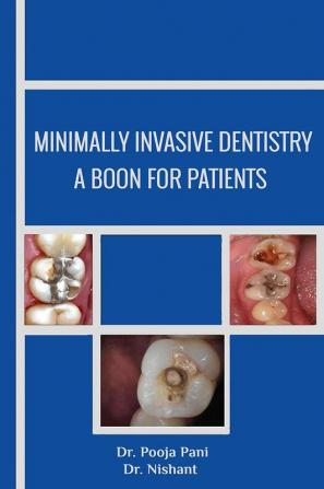 Minimally Invasive Dentistry- a boon for patients