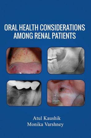 Oral Health Considerations Among Renal Patients