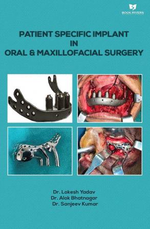 Patient Specific Implant In Oral & Maxillofacial Surgery