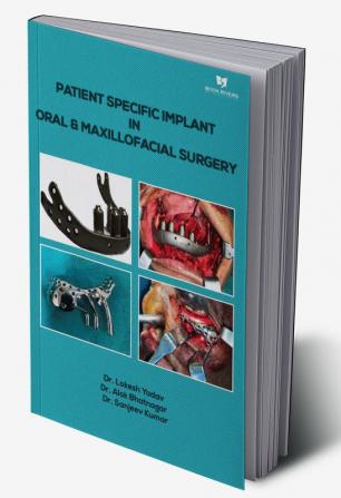 Patient Specific Implant In Oral & Maxillofacial Surgery