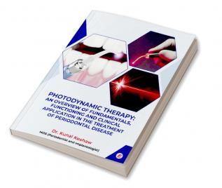 Photodynamic Therapy An Overview Of Fundamentals Functioning And Clinical Application In The Treatment Of Periodontal Disease