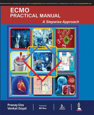 ECMO Practical Manual: A Stepwise Approach