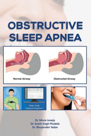 Obstructive Sleep Apnea