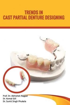 Trends in Cast Partial Denture Designing