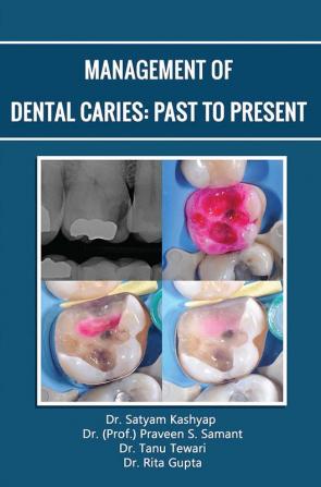 Management Of Dental Caries: Past To Present