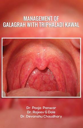 Management of Galagrah with Triphaladi kawal