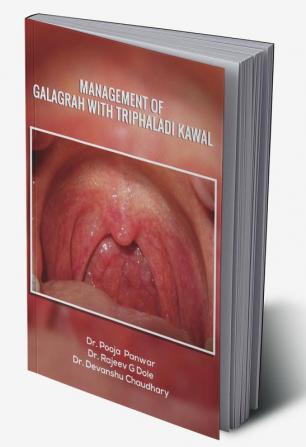 Management of Galagrah with Triphaladi kawal