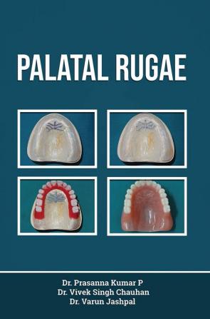 Palatal Rugae