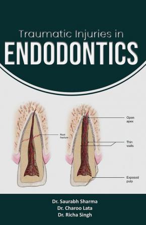 Traumatic Injuries in Endodontics