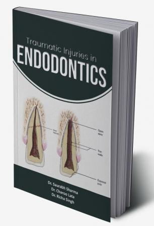 Traumatic Injuries in Endodontics