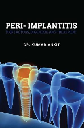 Peri-Implantitis:  Risk Factors Diagnosis And Treatment