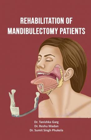 Rehabilitation of Mandibulectomy Patients