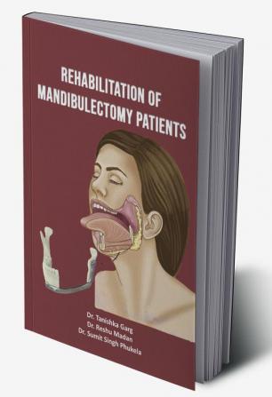 Rehabilitation of Mandibulectomy Patients