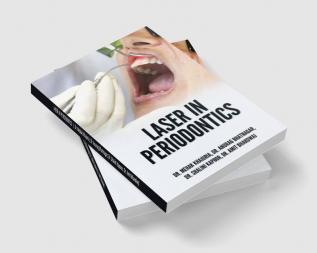 LASER IN PERIODONTICS