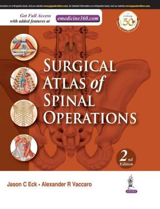 Surgical Atlas of Spinal Operations