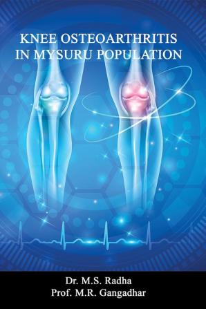 Knee Osteoarthritis In Mysuru Population