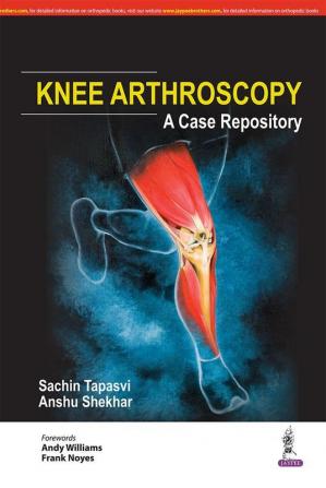 KNEE ARTHROSCOPY: A CASE REPOSITORY