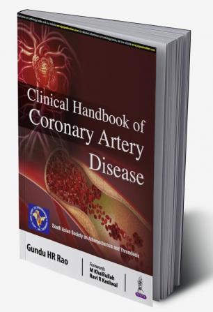 Clinical Handbook of Coronary Artery Disease