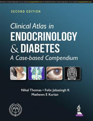 Clinical Atlas in Endocrinology and Diabetes: A Case-based Compendium