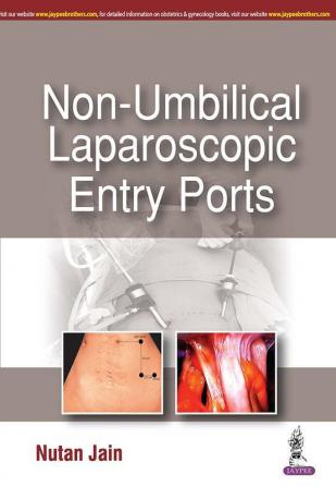 Non-Umbilical Laparoscopic Entry Ports