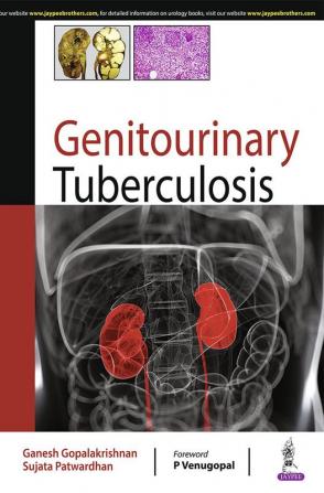 GENITOURINARY TUBERCULOSIS