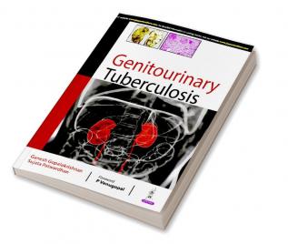 GENITOURINARY TUBERCULOSIS