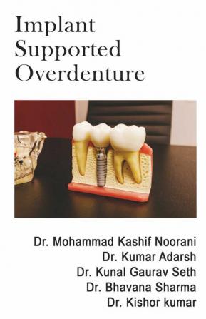 Implant Supported Overdenture