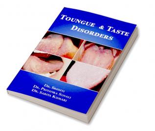 TONGUE AND TASTE DISORDERS