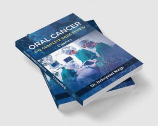 Oral Cancer The Complete Basic Review