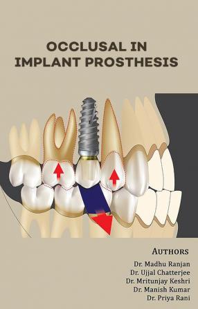 OCCLUSAL IN IMPLANT PROSTHESIS