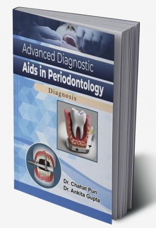 Advanced Diagnostic Aids in Periodontics