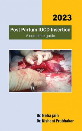 Post Partum IUCD Insertion