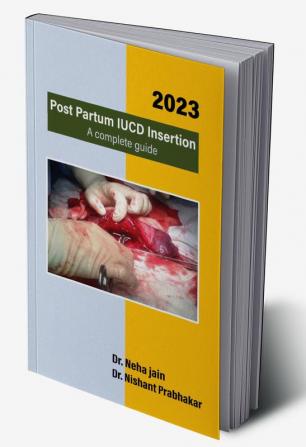 Post Partum IUCD Insertion