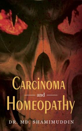 Carcinoma And Homoeopathy