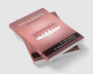 Implantology