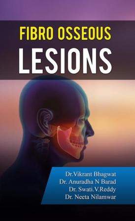 Fibro osseous lesions