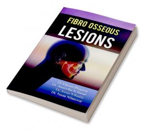 Fibro osseous lesions