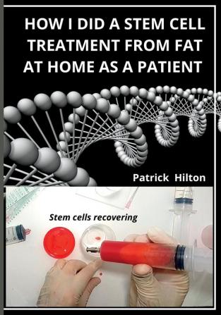 How I Did a Stem Cell Treatment From Fat at Home as a Patient