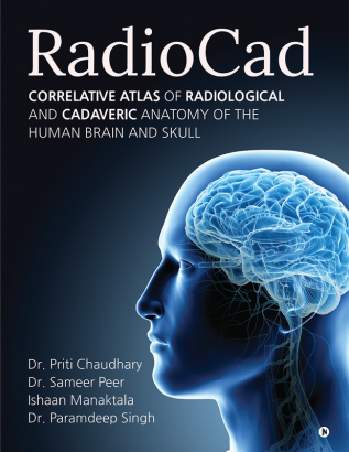 RadioCad : Correlative Atlas of Radiological and Cadaveric Anatomy of the Human Brain and Skull