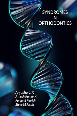 SYNDROMES IN ORTHODONTICS