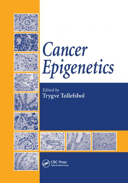 Cancer Epigenetics