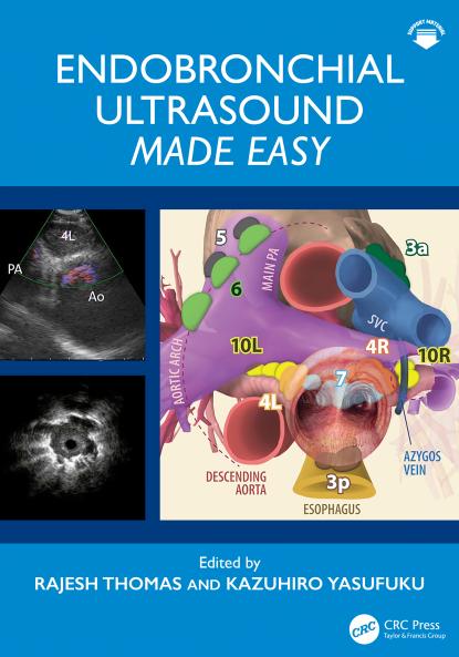 Endobronchial Ultrasound Made Easy