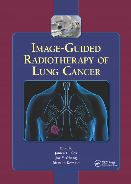 Image-Guided Radiotherapy of Lung Cancer