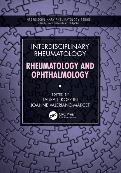 Interdisciplinary Rheumatology: Rheumatology and Ophthalmology