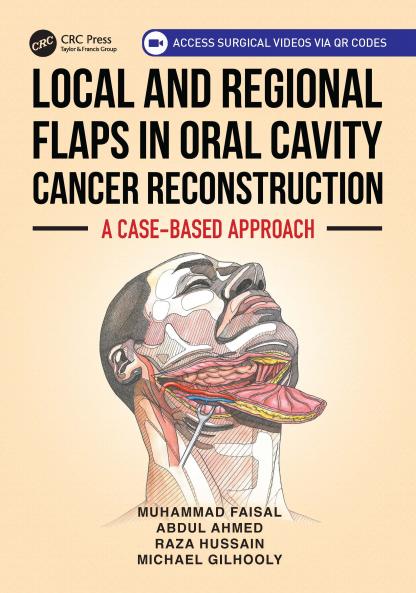 Local and Regional Flaps in Oral Cavity Cancer Reconstruction