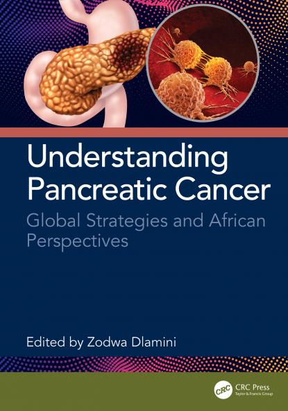Understanding Pancreatic Cancer